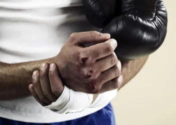 شایع‌ترین آسیب‌های کیک‌بوکسینگ و راه‌های پیشگیری